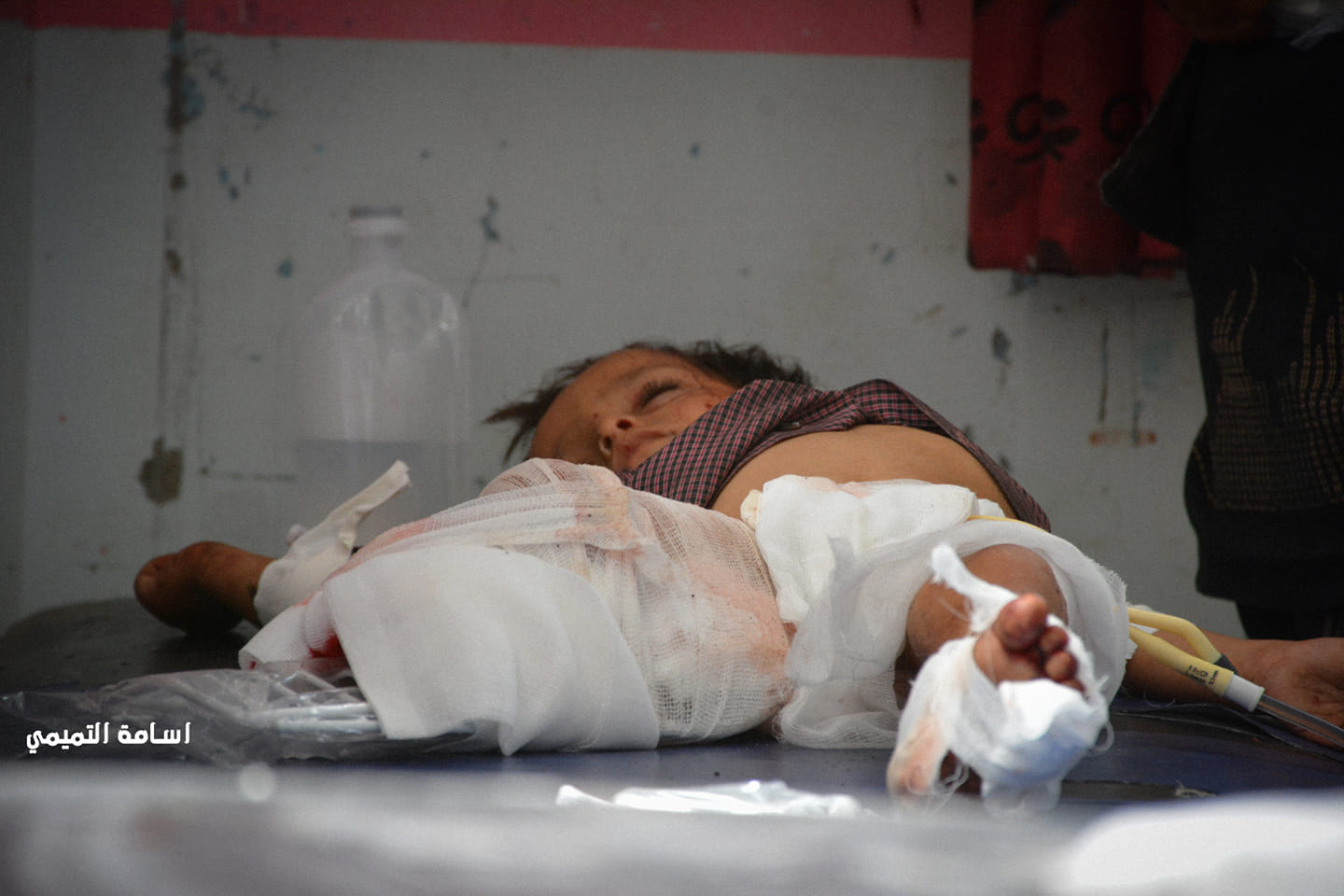 لجنة حكومية توثق مقتل وجرح 2764 طفلا في اليمن خلال سنوات الحرب