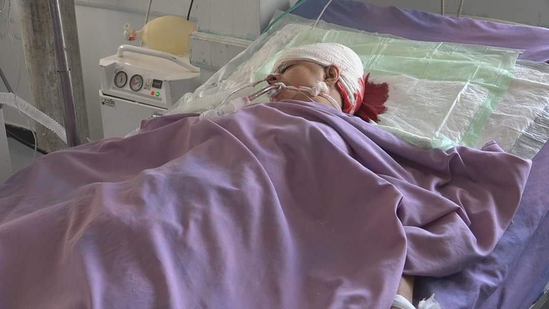 وفاة امرأة متأثرة بإصابتها برصاص قناص حوثي في تعز جنوب غربي اليمن