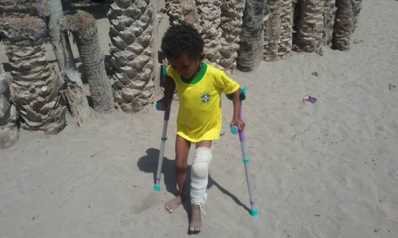 انفجار لغم حوثي يتسبب ببتر قدمي ويد طفل في حجة غربي اليمن
