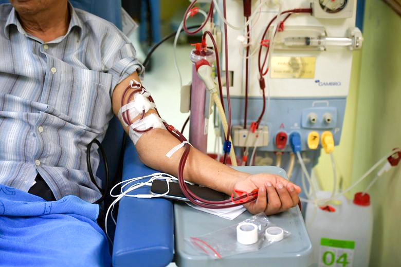 الحوثيون يحذرون من وفاة خمسة آلاف مريض فشل كلوي جراء نفاد الأودية