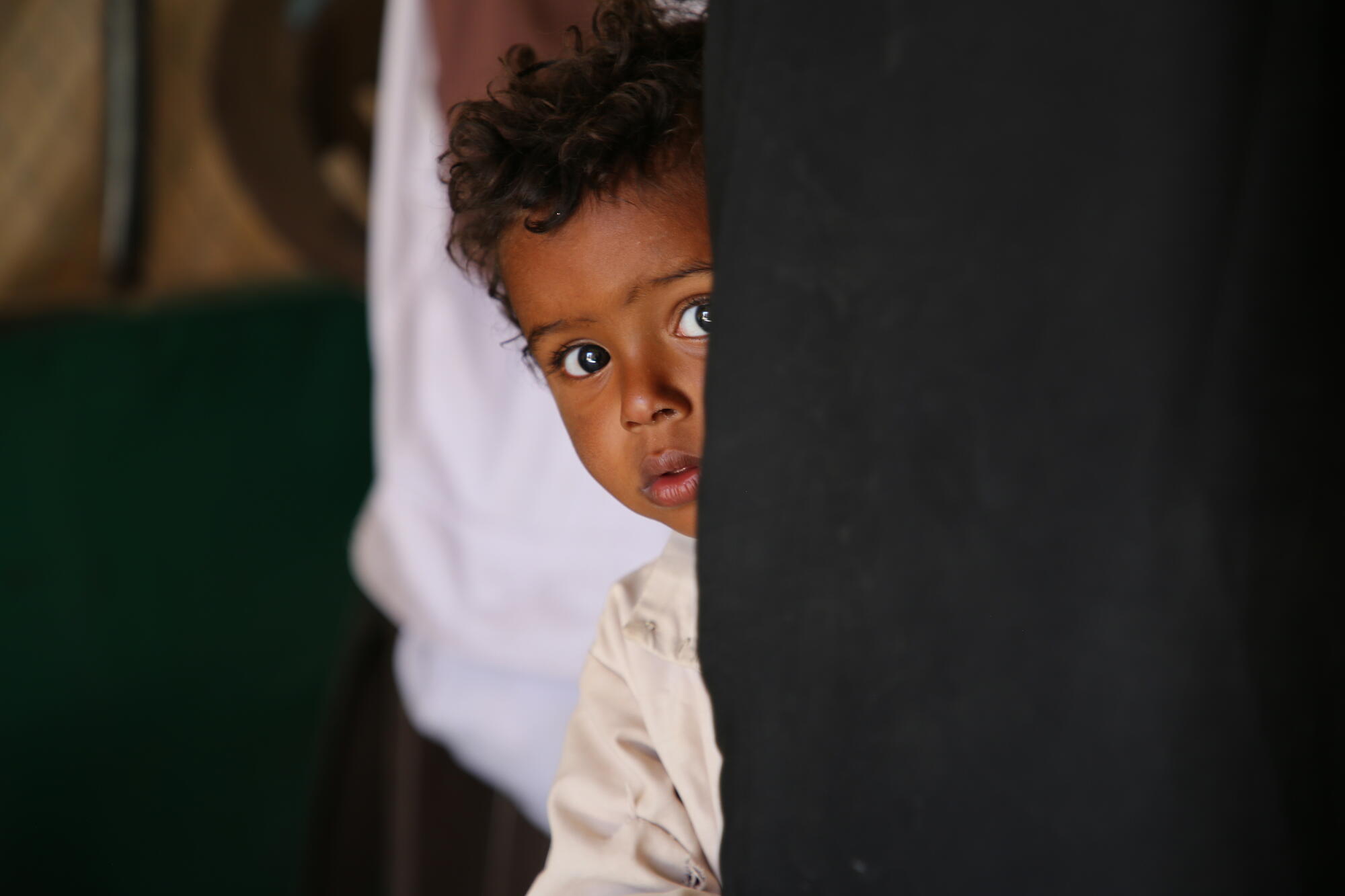 أطباء بلا حدود: سوء التغذية في اليمن لا يزال مقلقًا للغاية