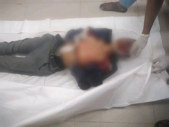 وفاة طفل متأثراً بإصابته جراء قصف حوثي لحي سكني في تعز