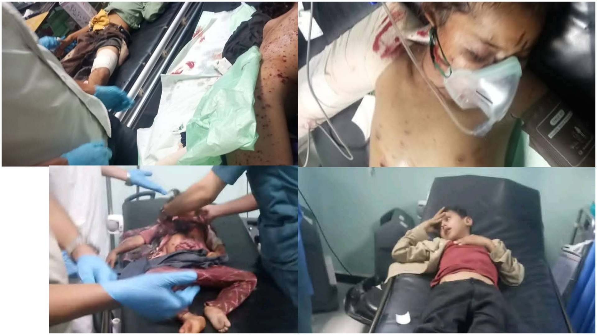 كلفة خالية لإلغاء الشهوات.. تفاصيل المجزرة التي خطفت براءة أطفال الضالع كلفة خالية لإلغاء الشهوات.. تفاصيل المجزرة التي خطفت براءة أطفال الضالع