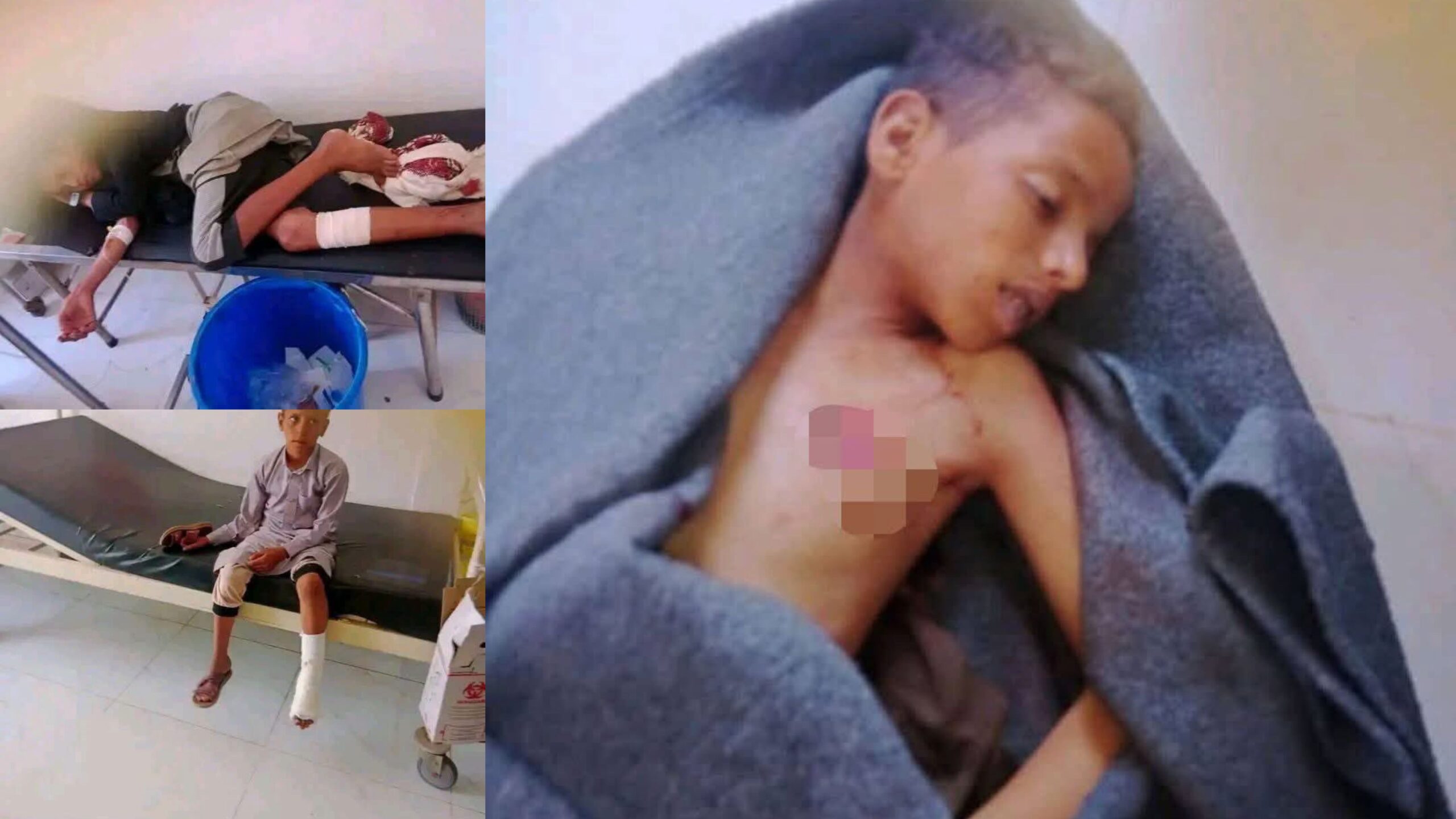 قتلى وجرحى أبناء جبلات قبلية شمالي صنعاء قتلى وجرحى أبناء جبلات قبلية شمالي صنعاء